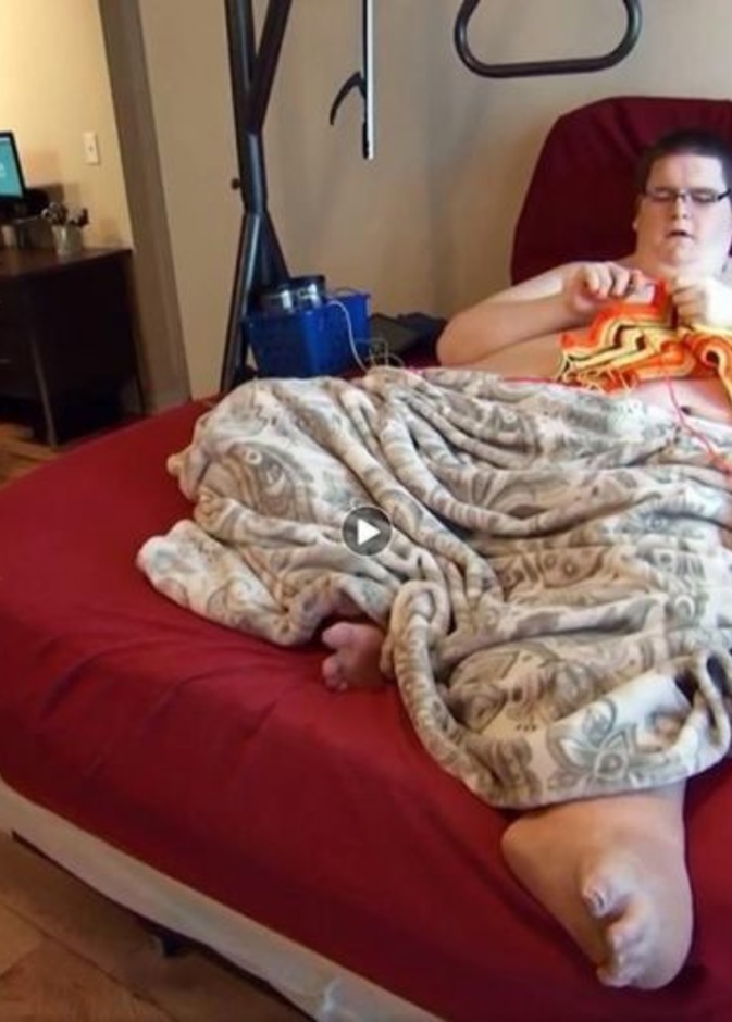 شون ميليكين عانى من مشكلة الوزن المفرط مبكرا