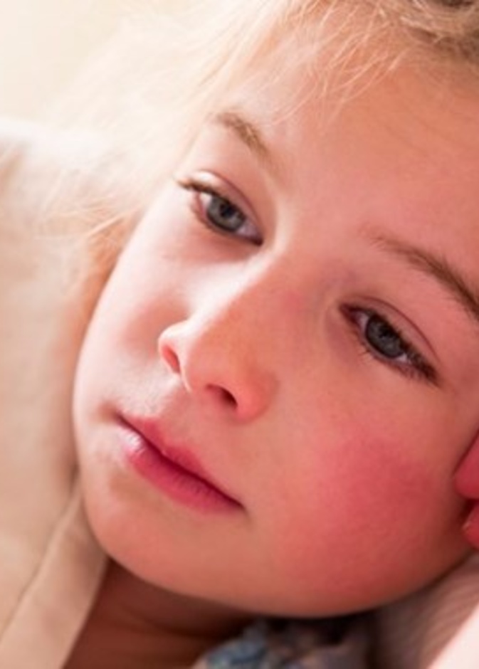 اعراض الحمى القرمزية عند الاطفال وطرق علاجها والوقاية منها