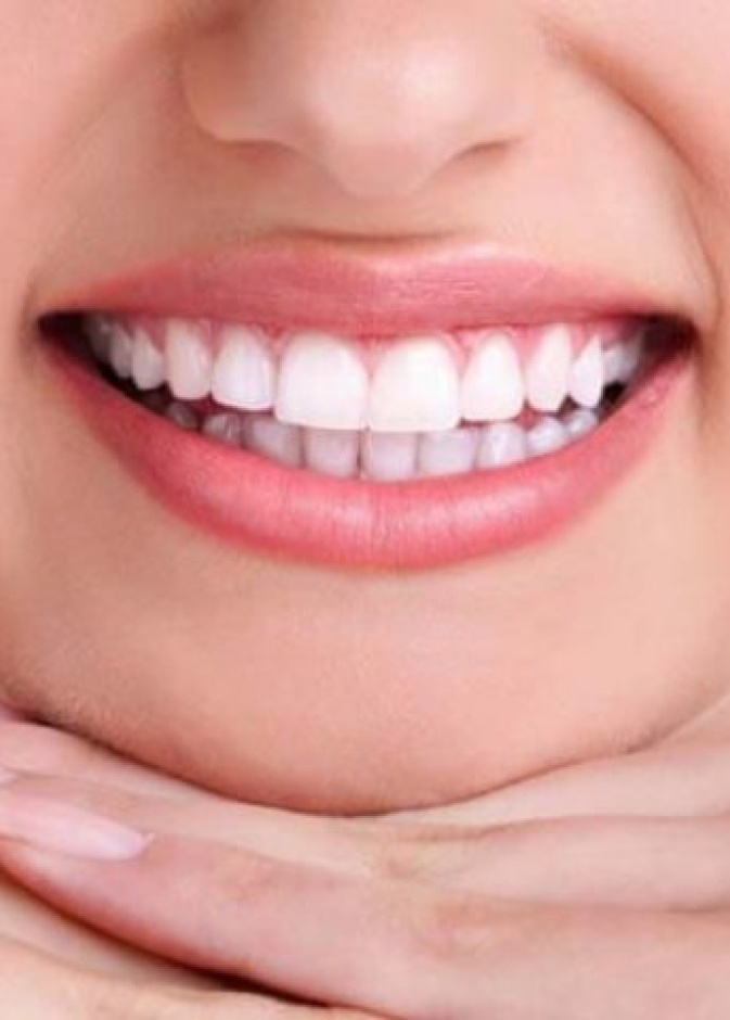 الابتسامة اللثوية لها تأثير سلبي على جمالية ابتسامتك