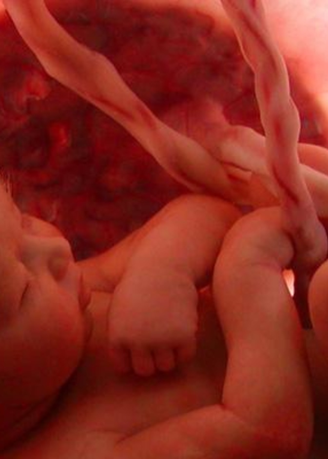 أسباب إلتفاف الحبل السري حول عنق الجنين