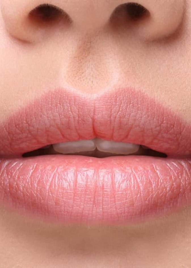 الفم الواسع هو عندما يكون فيه الطول الأفقي للفم من زاوية إلى أخرى طويلاً أو واسعاً