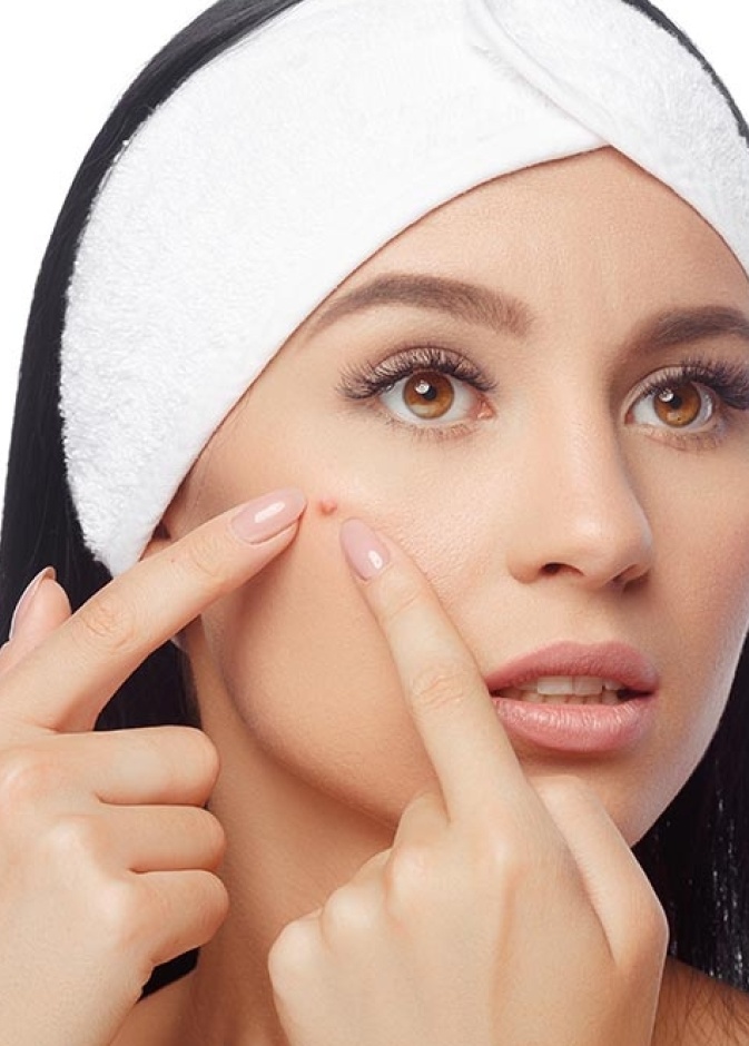 ابتعدي عن الادوية لعلاج حب الشباب