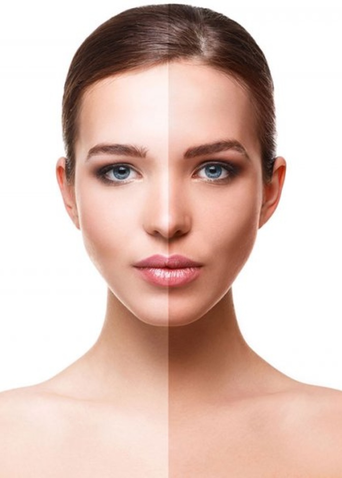 غيري لون جلدك بمساعدة فراكشنال ليزر