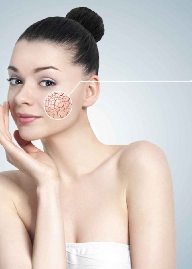 خلطات طبييعية لازالة اثار الحروق القديمة