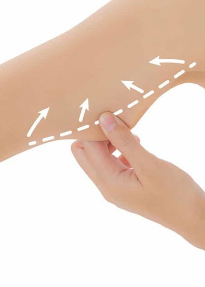 شفط الدهون بالليزر هو إجراء تجميلي يستخدم لإذابة الدهون تحت الجلد