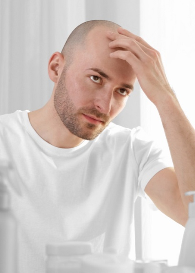 أسباب تساقط الشعر عند الرجال 