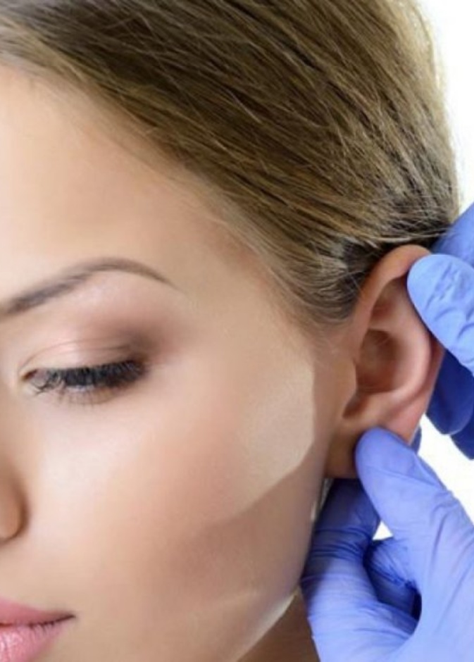 جئي لعملية تجميل الأذن إذا كنت تعانين من الآذان الخفاشية