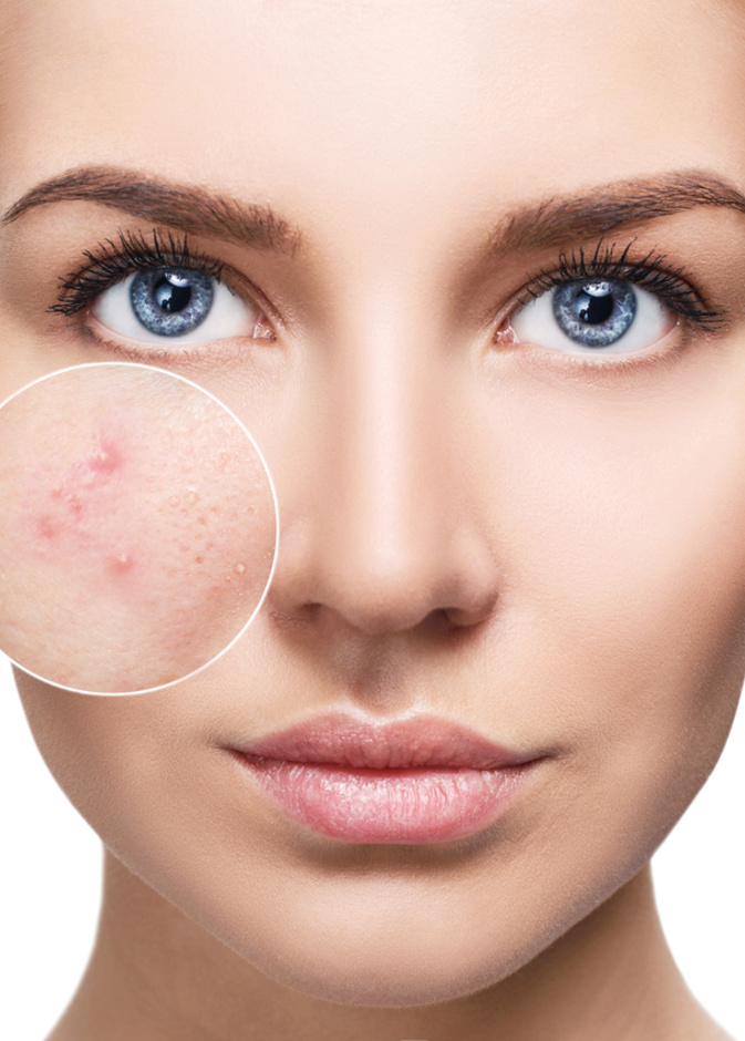 احرصي على ترطيب بشرتك للحفاظ على نضارتها ليلاً