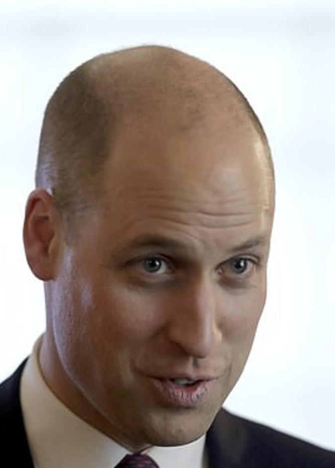 إصابة الأمير وليام بالصلع سببت أزمة لمصممي العملات التذكارية التي تحمل صوره