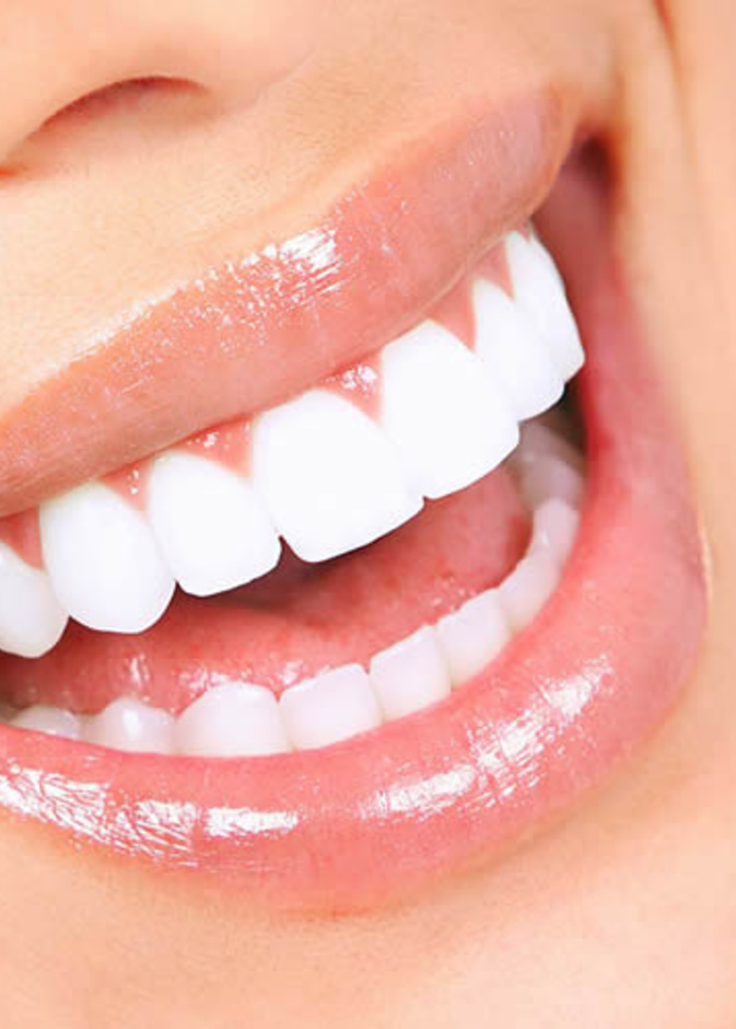 إليك أهم ما يميز تلبيس أسنان الزيركون