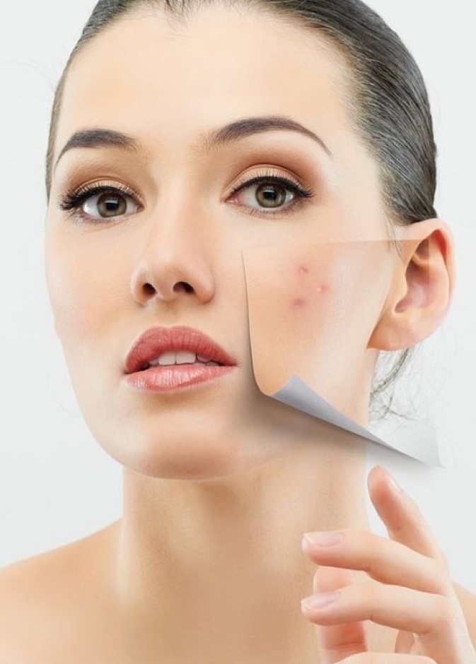 التصبغ الجلدي هو تراكم الخلايا الصباغية تحت الجلد