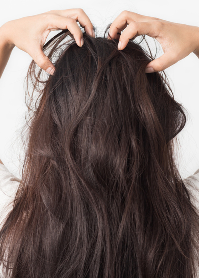 تجنبي تراكم الجلد الميتة لتجنب حكة فروة الرأس