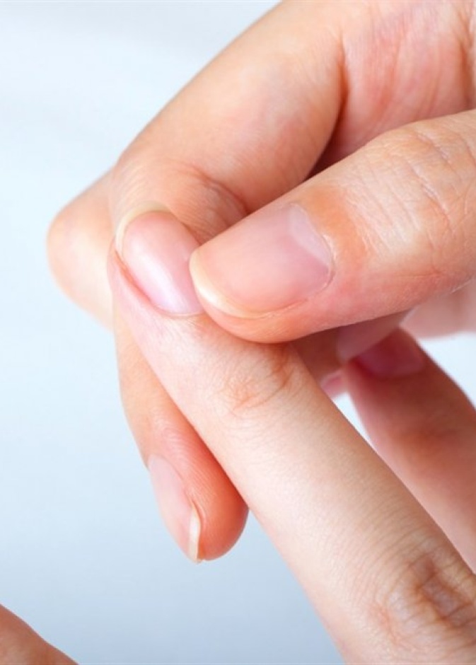  وصفات طبيعية لعلاج تقشر الجلد حول الاظافر