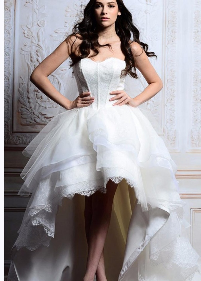 لا بد من تبييض الركب قبل الزفاف وشهر العسل