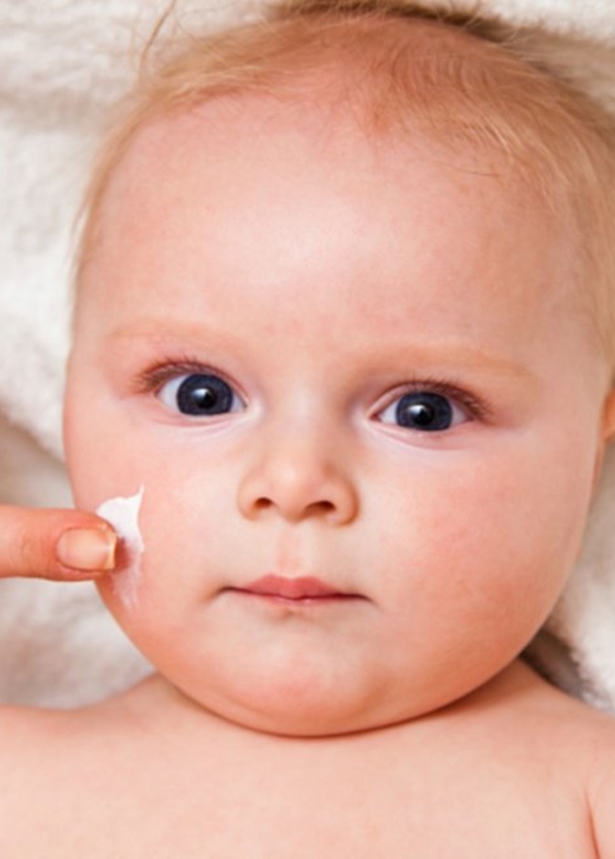 اسباب اكزيما الرضع