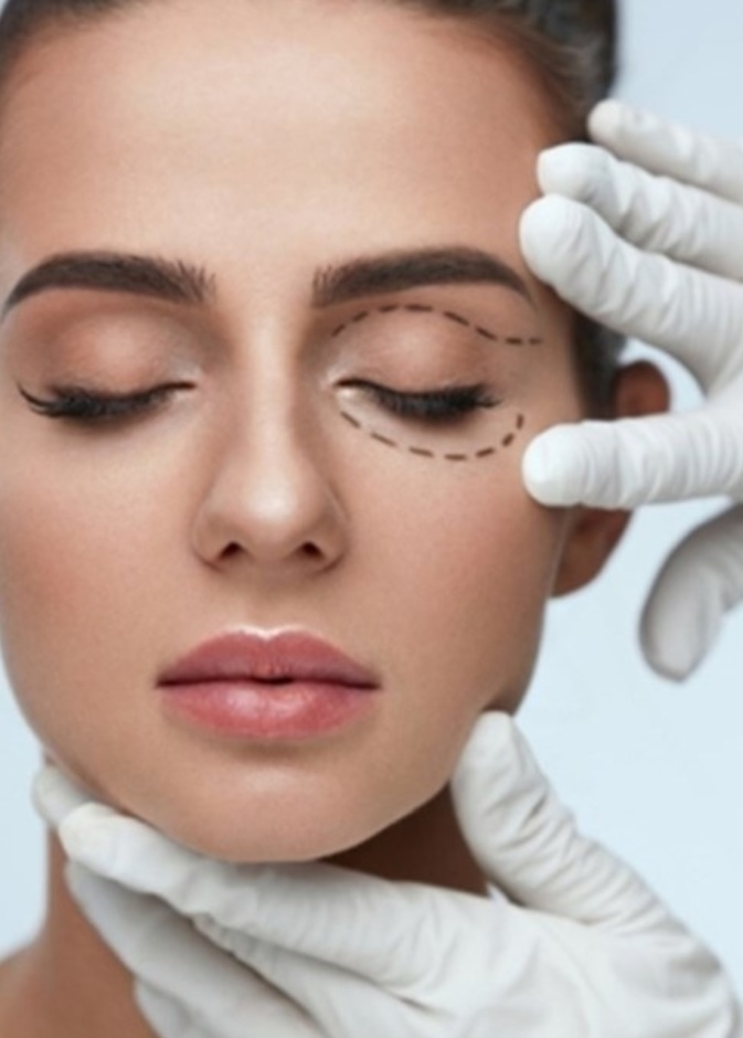 تجاعيد العين