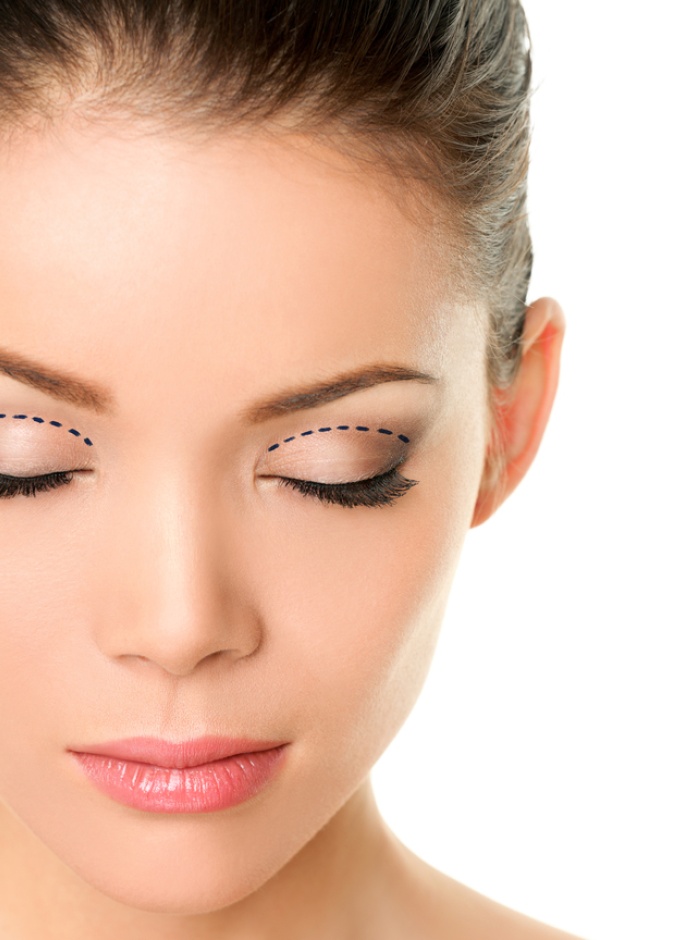 الجفن المزدوج