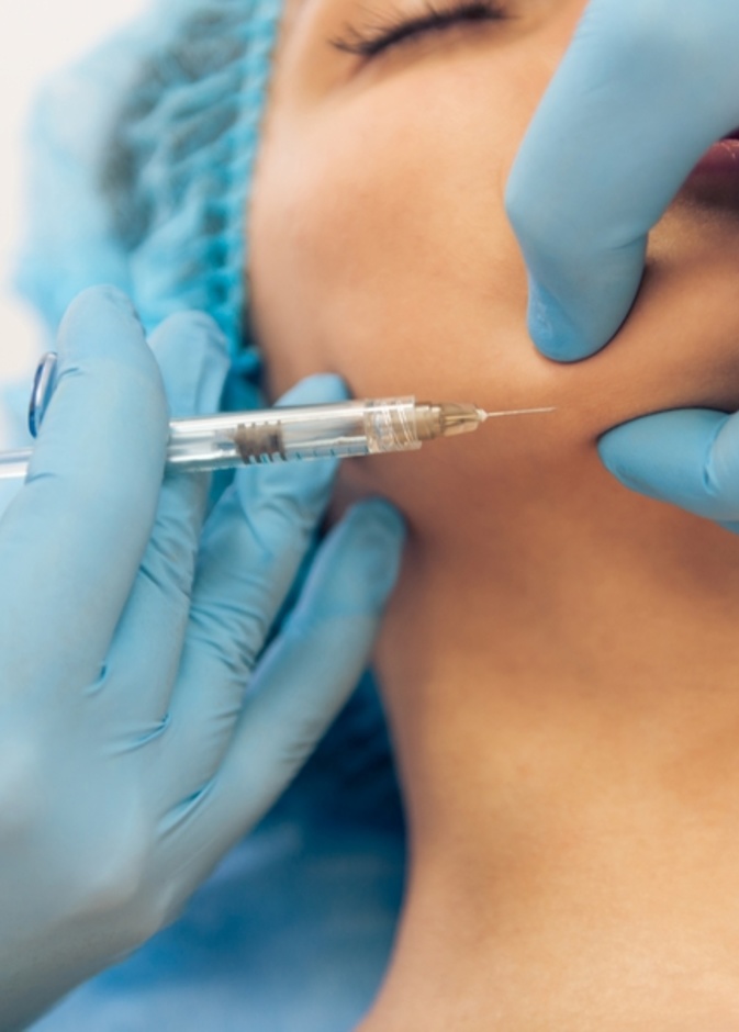 تجميل الحنك بتقنية تكساس