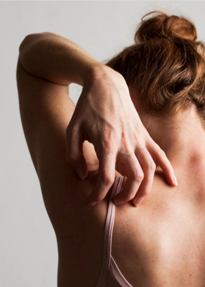 وصفات للتخلص من حبوب الظهر