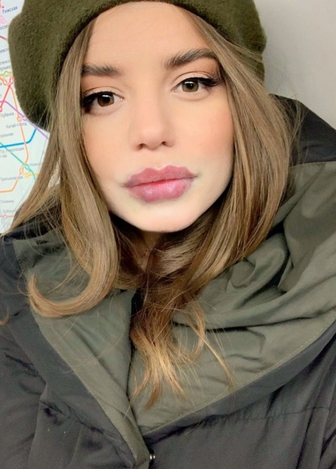 شفاه الأخطبوط تشمل إدخال حشو في الشفة الخارجية لإنشاء تأثير موجة عبر الشفتين