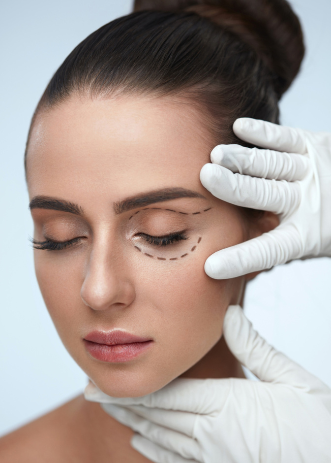 عملية جراحة الجفون