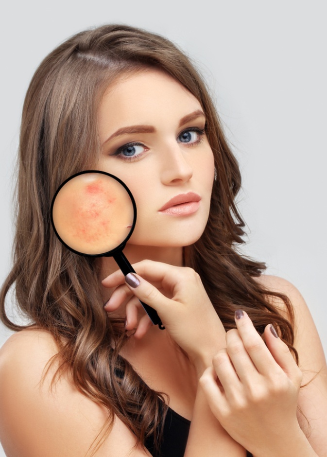 علاج التصبغات والبقع البنية 