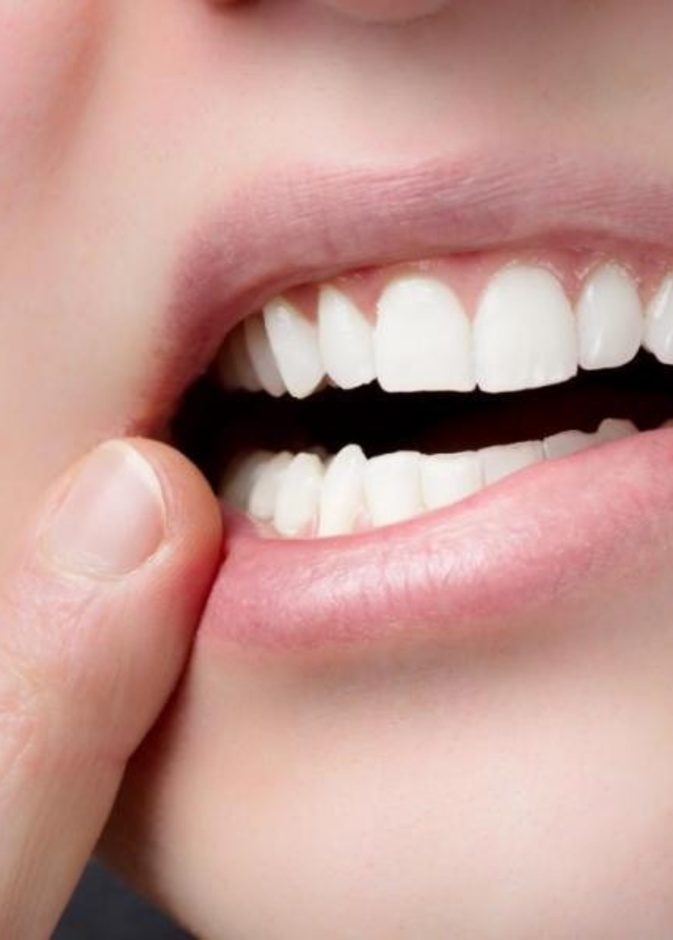 القلاع الفموي يسبب صعوبة في البلع