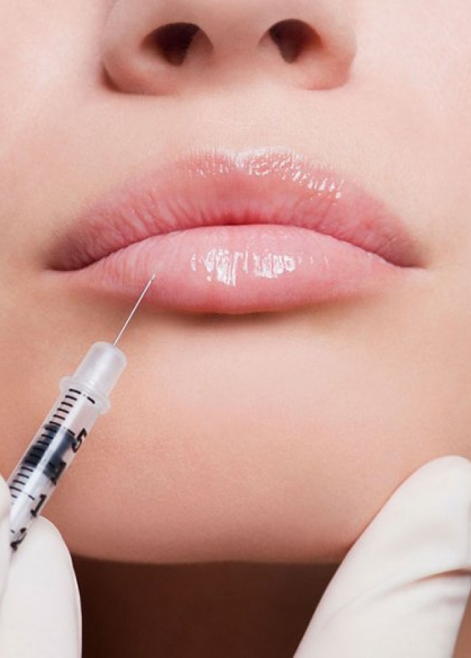 تجنبي إزالة شعر الوجه بالليزر أو أي وسيلة أخرى بعد ثلاثة أيام على الأقل من الحقن