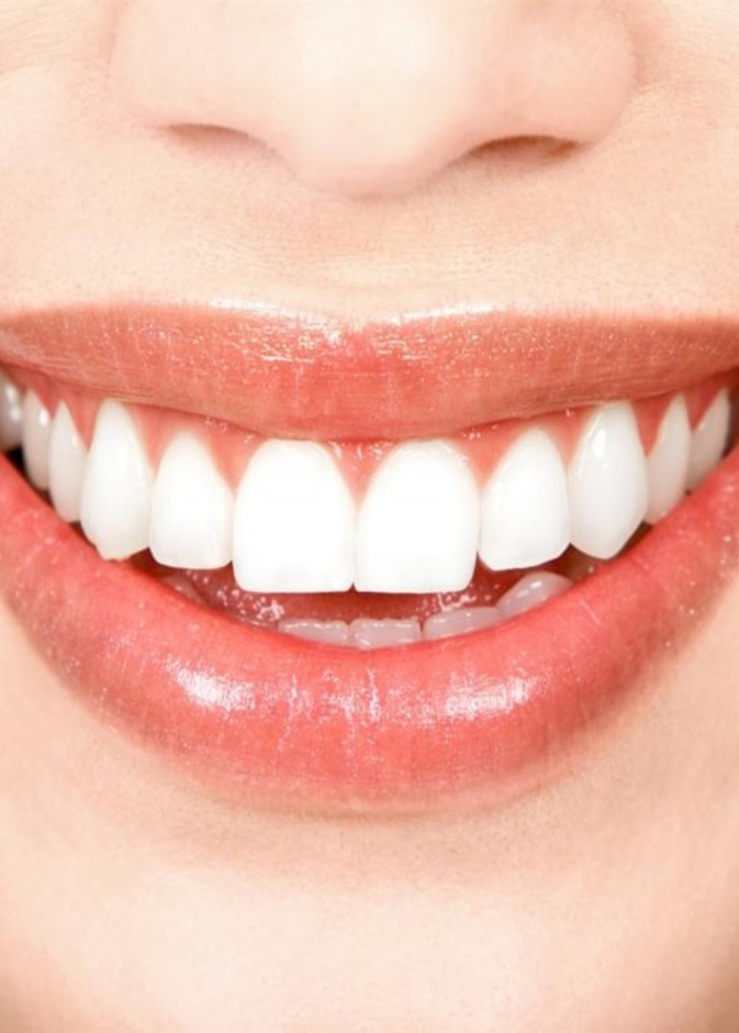 تعرفي على أهم مخاطر عملية زرع الأسنان لتجنب أي آثار جانبية بعد الخضوع إليها