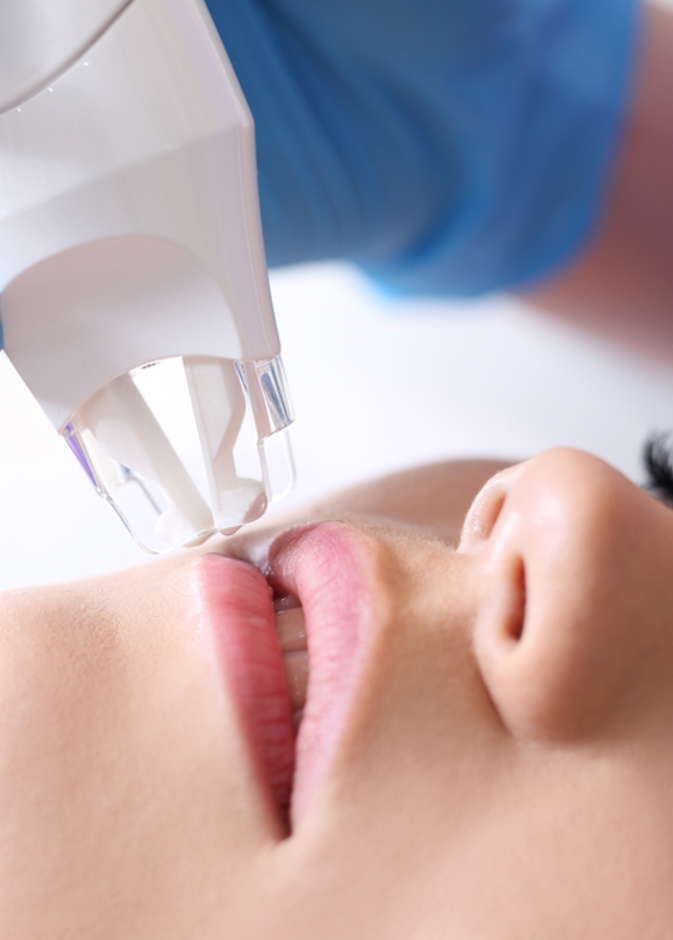 أصبح الليزر الحل الأكثر اعتماداً من قبل النساء والأطباء لتصغير الشفايف