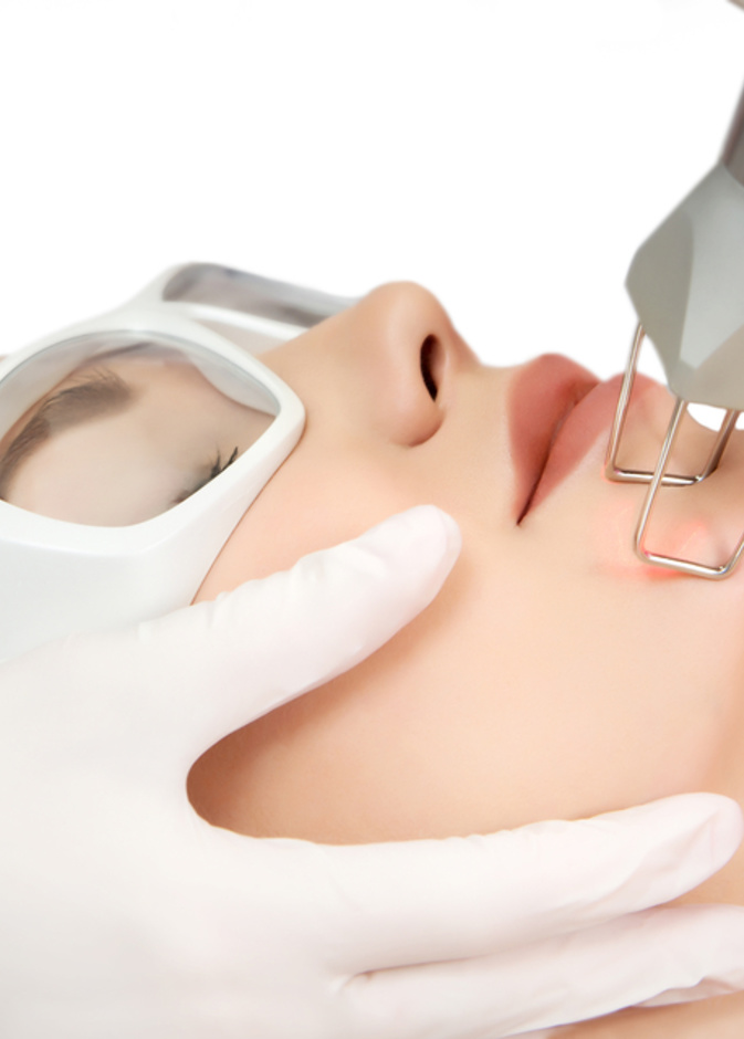 ما هو علاج الأوعية الدموية للوجه بالليزر