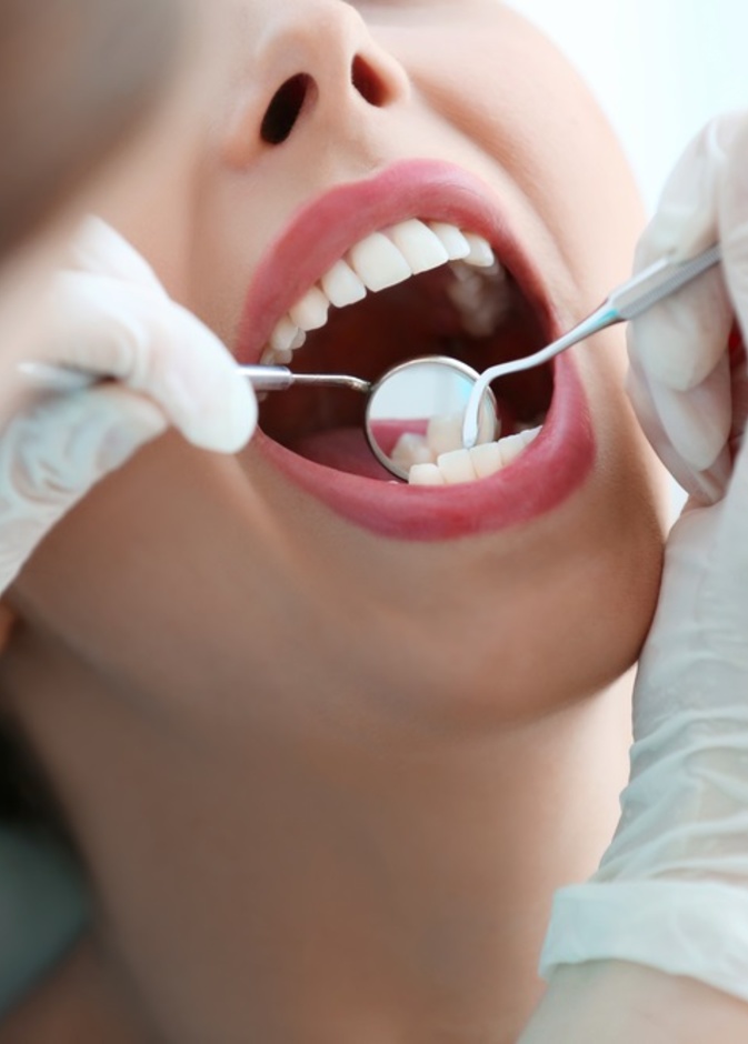 اسباب تسوس الاسنان عند الكبار وطرق الوقاية منها
