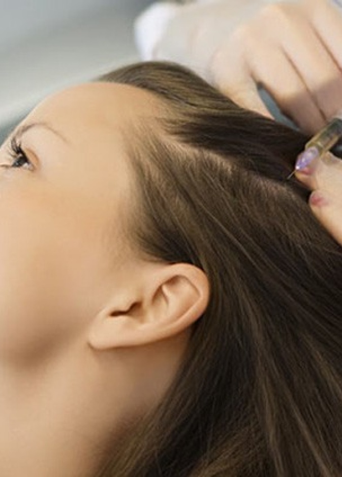 حقن البلازما الغنية بالصفائح الدموية قد تساعد في تقليل تساقط الشعر 