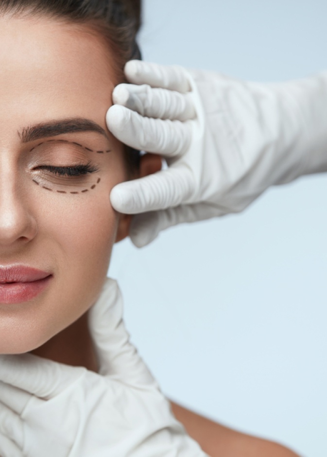 ما هي عملية عيون القطة وأهم آثارها الجانبية