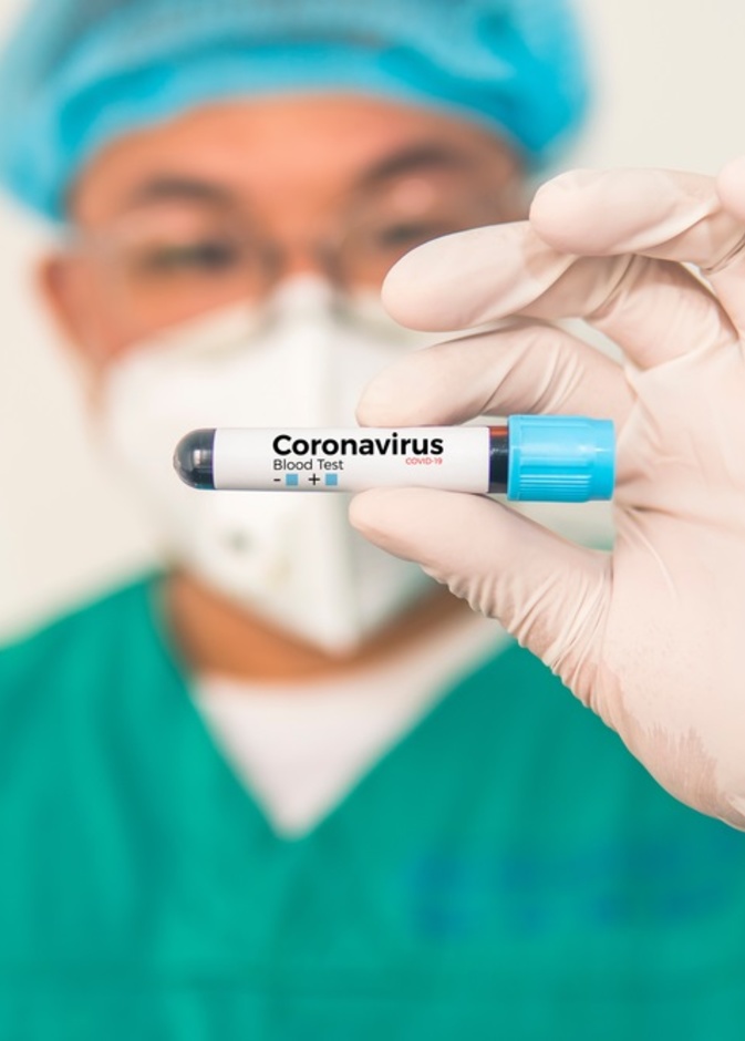 احتمالات الوفاة بسبب فيروس كورونا