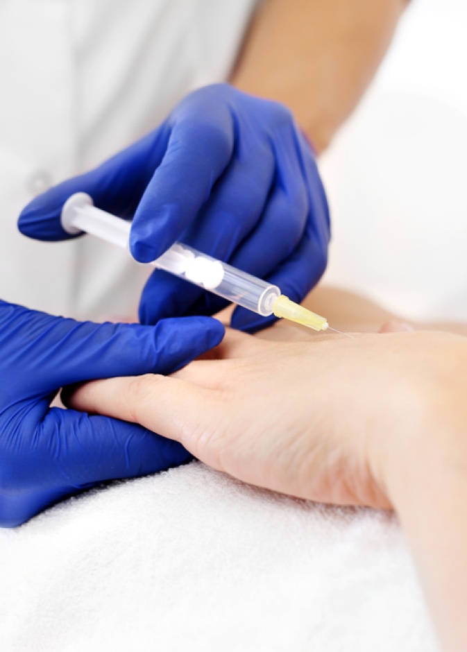 جربي حقن الفيلر للتخلص من تجاعيد اليدين