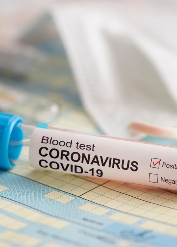 فيروس كورونا يبقى حياً في الهواء لعدة ساعات