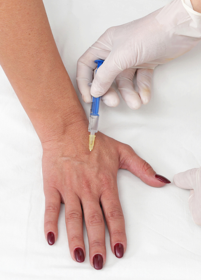 تعرفي على فوائد وأضرار عملية تجميل اليدين لإخفاء عروق اليد