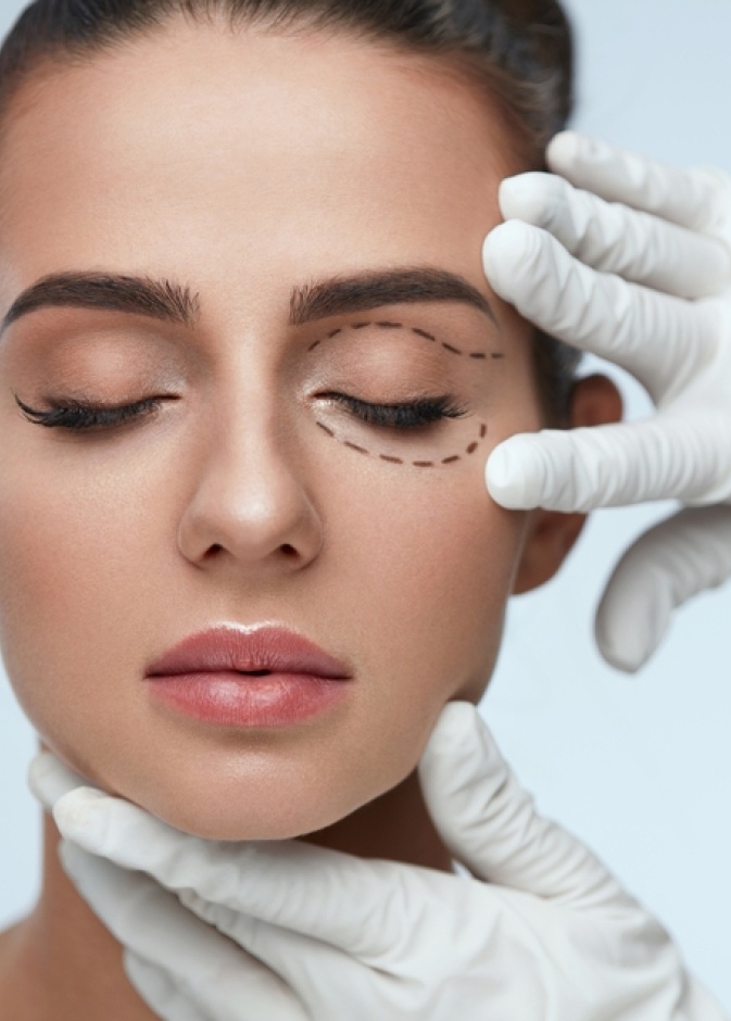  تخلصي من ترهلات العين والحاحب من خلال عملية رفع الحواجب