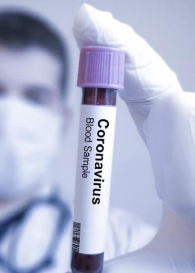  فيروس كورونا له مضاعفات خطيرة على الصحة