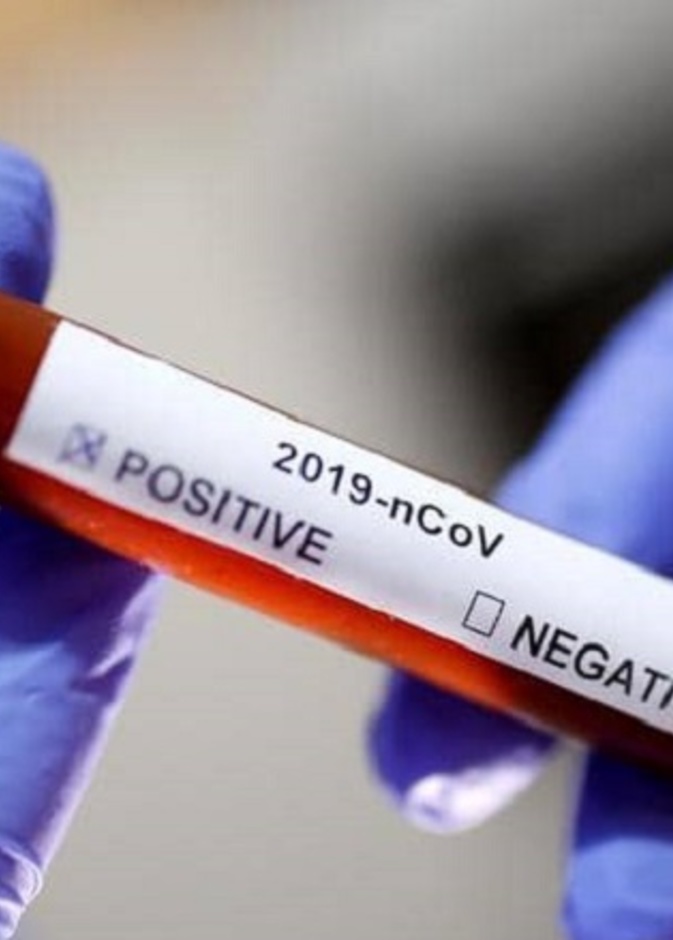  الاجسام المضادة لم تثبت فعاليتها في علاج كورونا