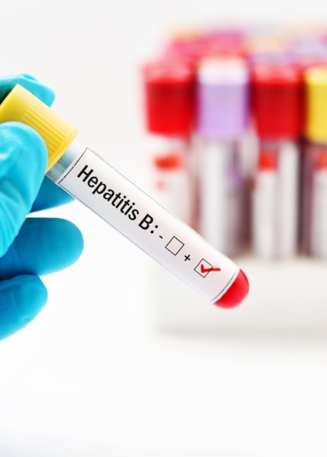 اسباب التهاب الكبد الوبائي ب