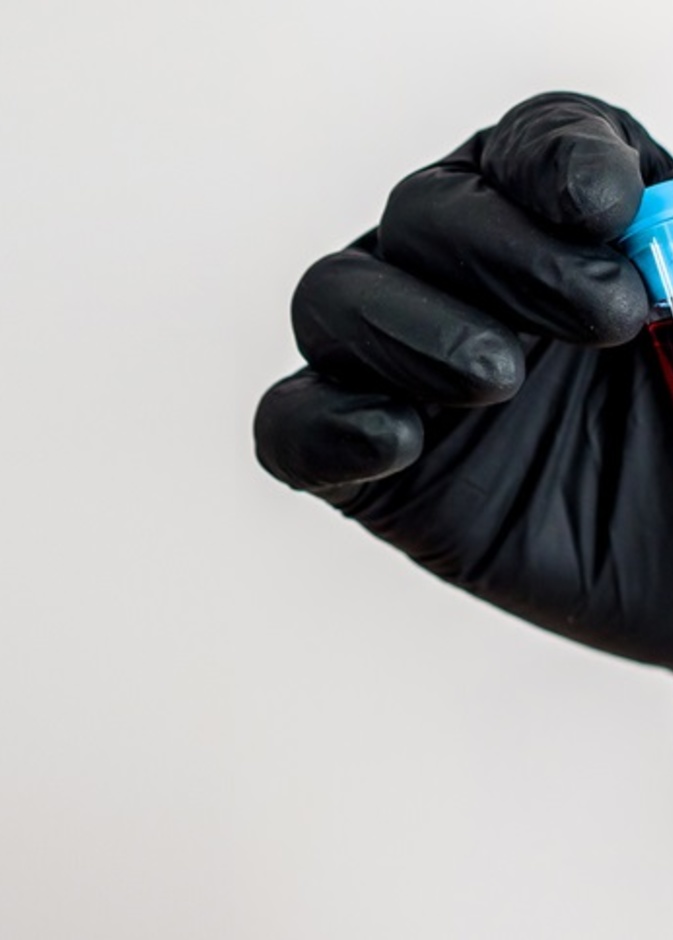 دراسة تنفي وجود علاقة بين عقاقير الأمراض المزمنة وفيروس كورونا 