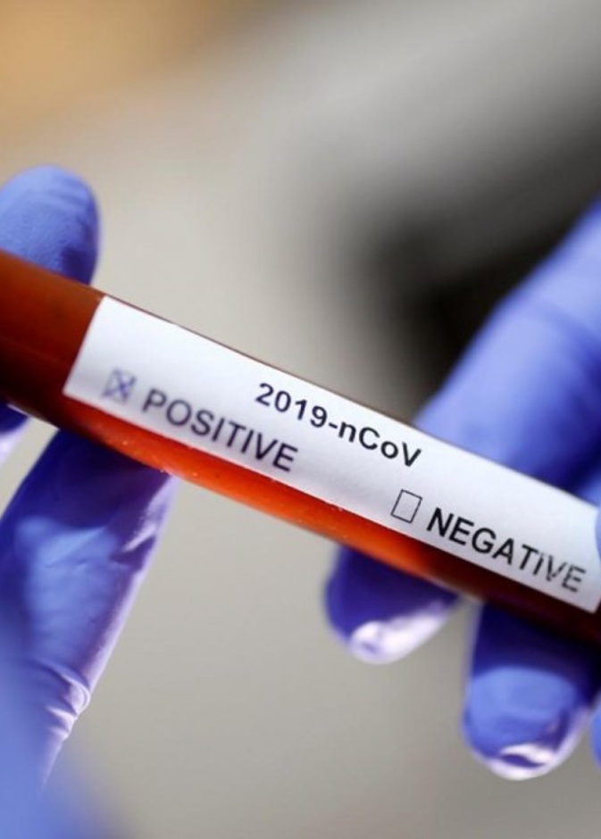  الدراسات تكشف عن أضرار جديدة لفيروس كورونا