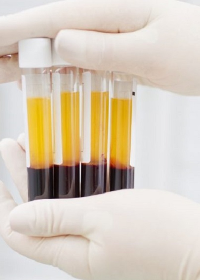 اهم المعلومات عن علاج كورونا ببلازما المتعافين