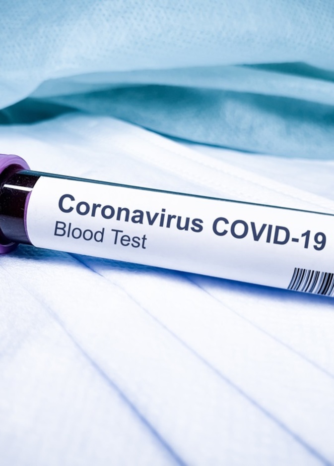 اكتشاف نقطة الضعف القاتلة لفيروس كورونا