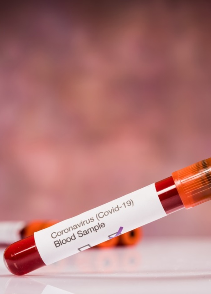 معلومات عن فصيلة الدم a الأكثر عرضة للإصابة بفيروس كورونا؟
