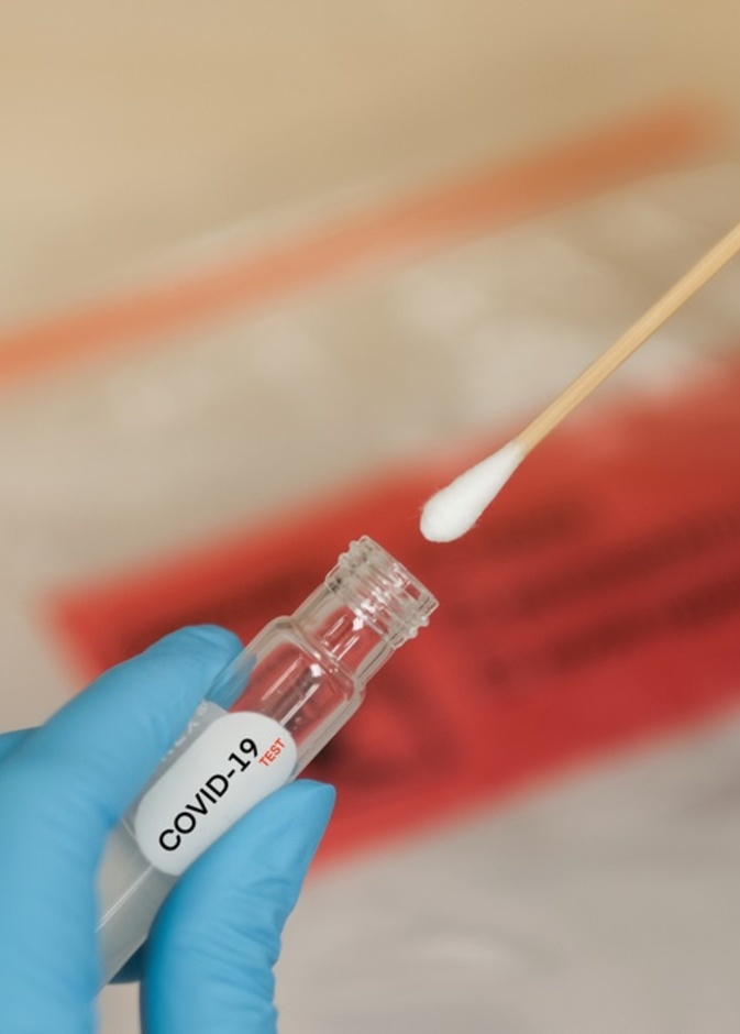 اختبارات الكشف عن فيروس كورونا 