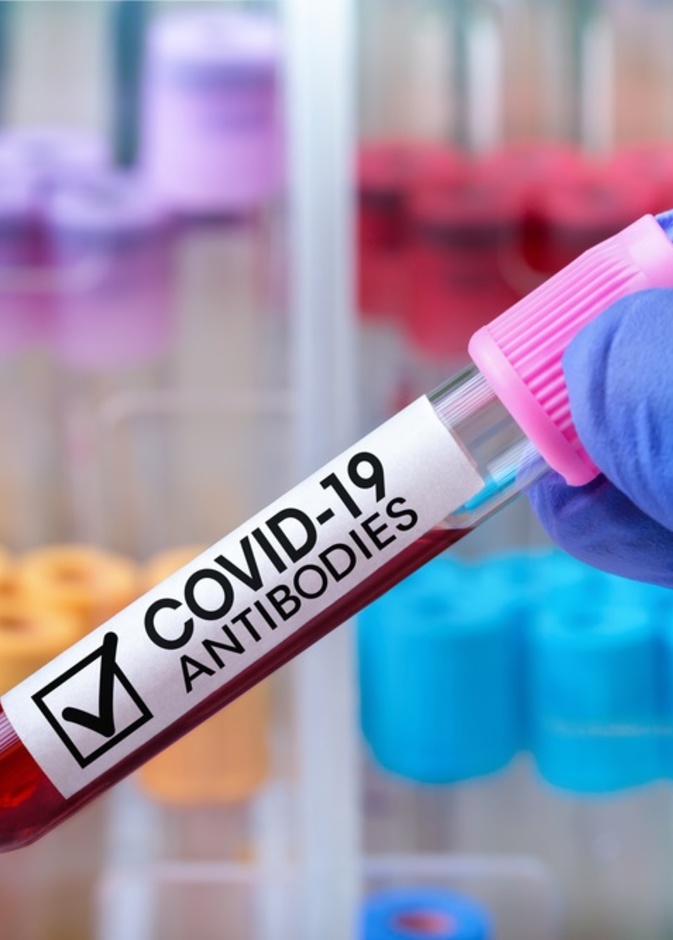 دماء حيوان اللاما تقلل نشاط فيروس كورونا