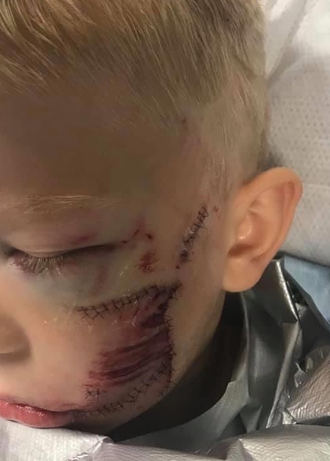 بطل عمره 6 سنوات